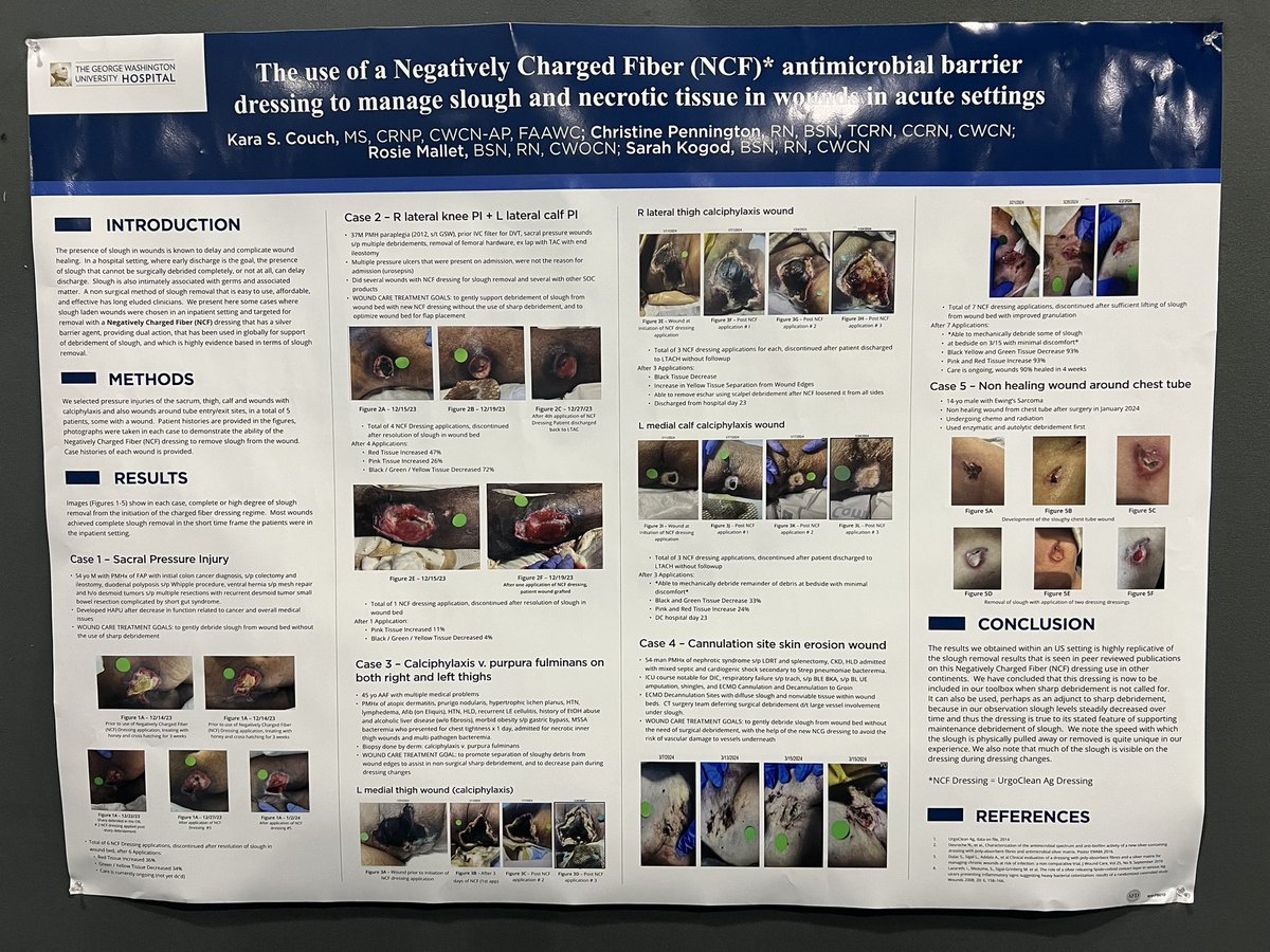 karacouch's tweet photo. Super proud that both of the GW wound care posters were nominated for People’s Choice Awards at #SawcSpring
Our prospective case series on use of a 3 layer patch to treat DFU outperformed the Lancet RCT. We healed 11/24 patients and no amputation. @GWSurgery @GWvascsurg https://t.co/9qAh7o1BYO