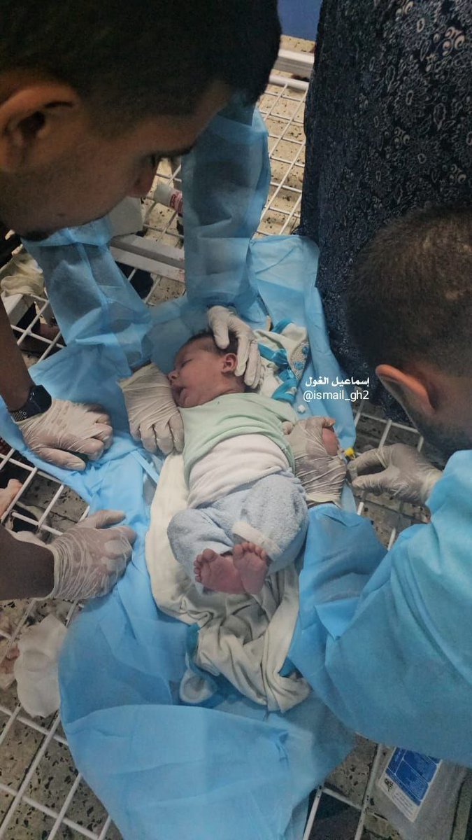 📸 A child was injured by an Israeli occupation bombing on the Sheikh Radwan neighborhood, north of Gaza city, last night
#IsraeliNewNazism 
#blockout2024
#BoycottIsrealProducts 
#alleyesonrafah 
#GazaGenocide‌ 
#sudan