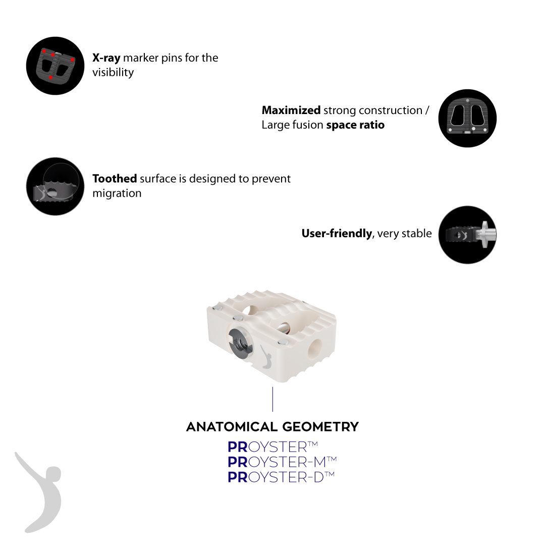 Anterior Cervical PEEK Cages & Bladed
PROYSTER™️
PROYSTER-M™️
PROYSTER-D™️

#prodorthspine #spinehealth #spinesurgery #spinedoctor #motionpreservation #spineimplant #spinedevice #cervicalcage #anteriorcervicaldiscectomyandfusion #postoperative