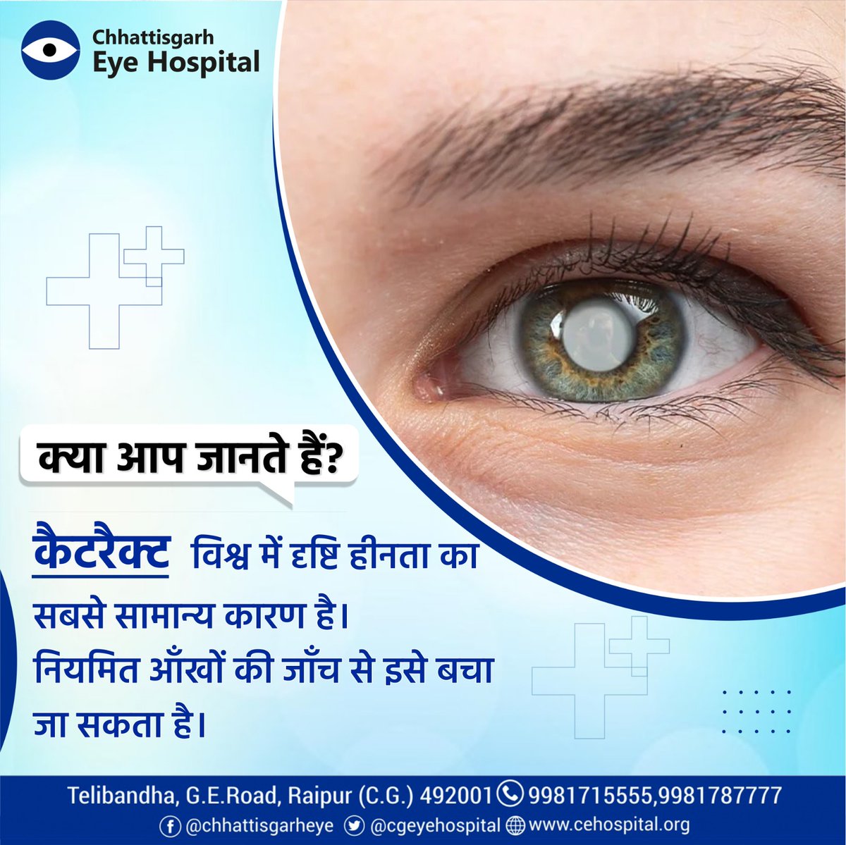 दुनियाभर में लाखों लोगों को मोतियाबिंद के कारण देखने में परेशानी होती है। ये आँखों के अंदरूनी लेंस को धुंधला कर देता है, जिससे चीज़ें साफ़ दिखाई नहीं देतीं। लेकिन घबराने की बात नहीं है
#eyehospital #eyecare