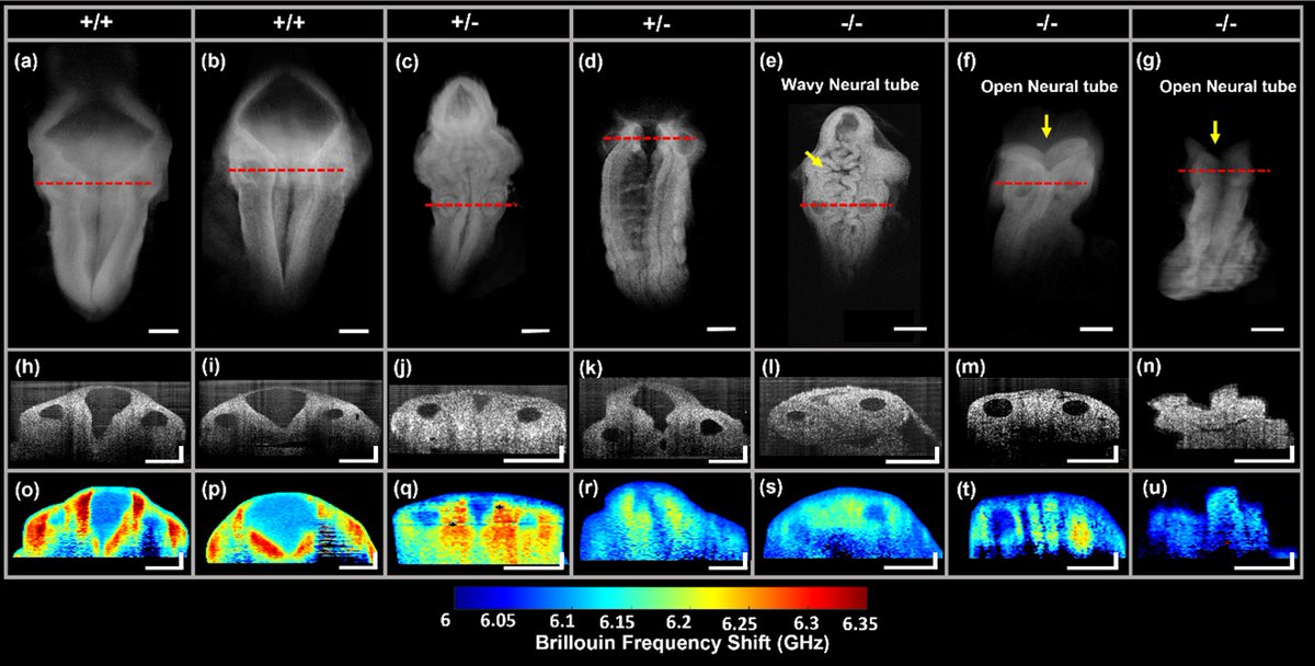 Optical coherence tomography-guided Brillouin microscopy highlights regional tissue stiffness differences during anterior neural tube closure in the Mthfd1l murine mutant Read this article by Yogeshwari Ambekar, Carlo Donato Caiaffa, Kirill Larin & co. journals.biologists.com/dev/article/15…