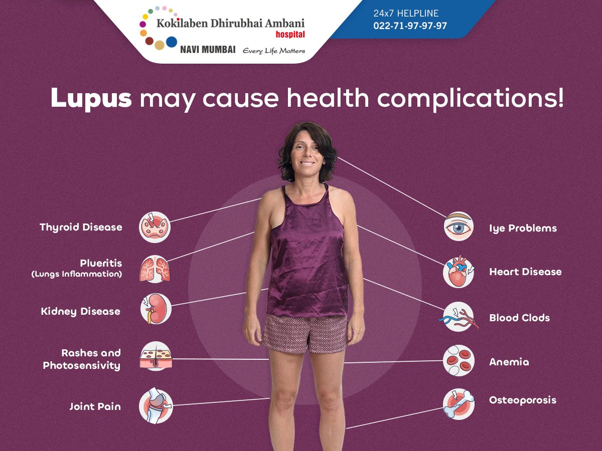 Lupus is a chronic autoimmune condition causing inflammation and organ damage. Complications like kidney damage, cardiovascular issues, and pregnancy complications can be severe. Early detection through regular check-ups is vital. #LupusAwarenessMonth #AutoimmuneDisease