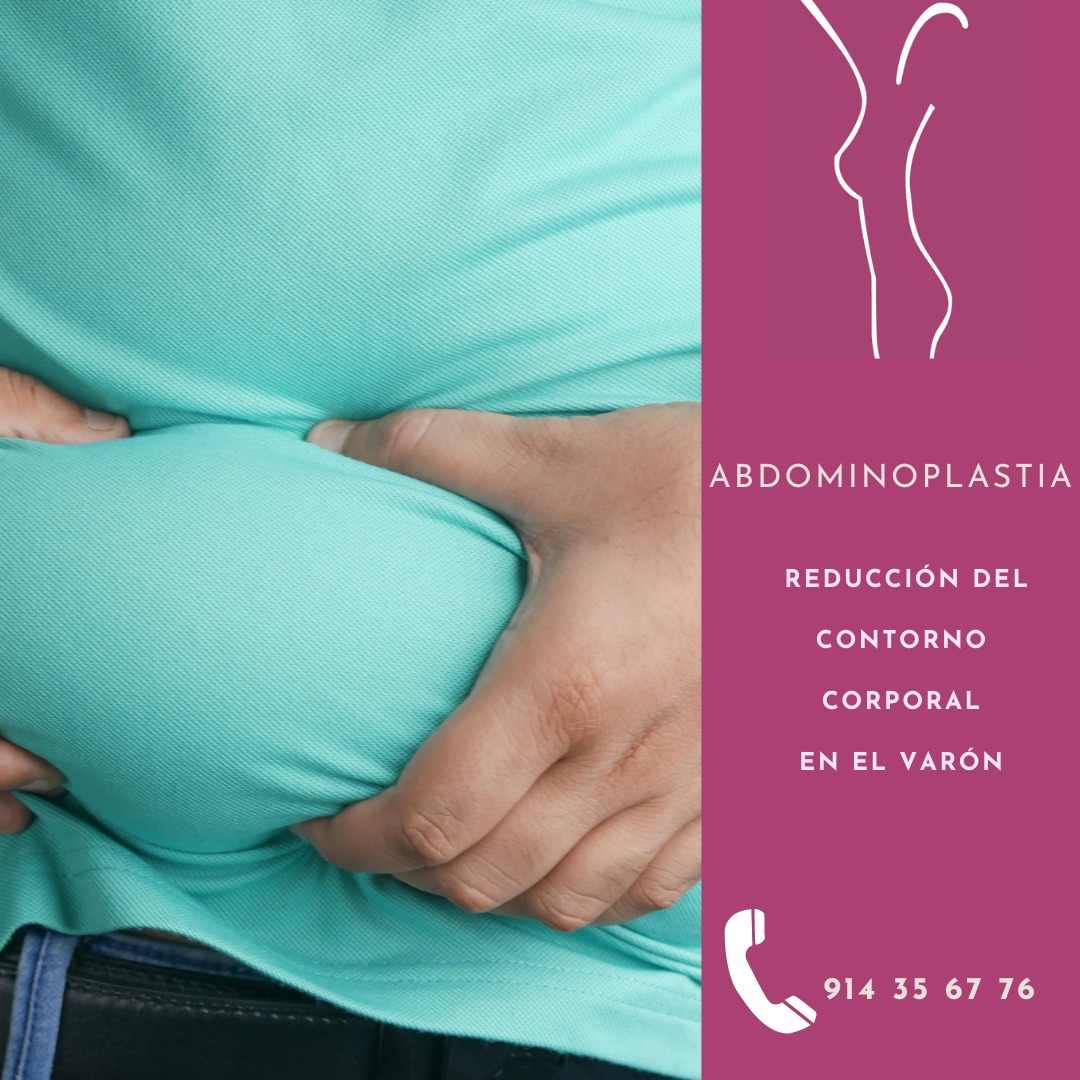 No es sólo estética, es #salud. La reducción de la #barrigamasculina supone un incentivo para el comienzo de una vida más sana, con especial atención a la #dieta y el #deporte. La cirugía  que lo logra es la #abdominoplastía.
#abdomenhombre #quitarbarrigahombre #saludyestética