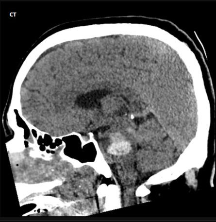 MRCEM Success tweet media