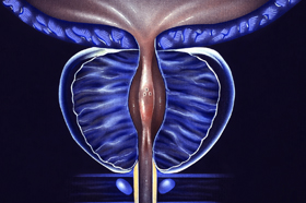 PSMA PET/CT SUVmax Helps Predict Likelihood of Clinically Significant Prostate Cancer in Biopsy Read more ➡️ bit.ly/3yoGsiT #RadNews #OncologicImaging #PETCT #ProstateCancer