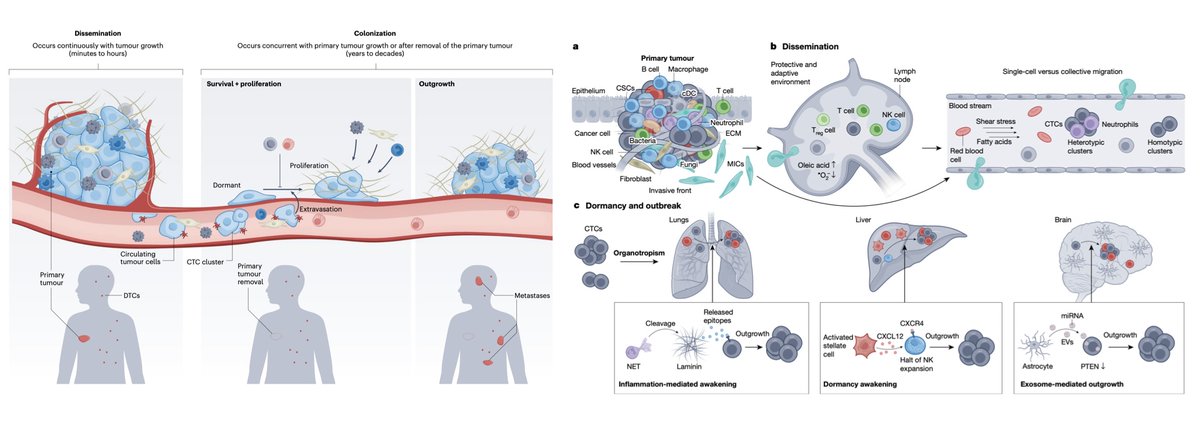 Two great new reviews on #metastasis - emphasizing the importance of epigenetic #plasticity & the tumor #microenvironment Lambert, Zhang & Weinberg nature.com/articles/s4155… Karras, Black, McGranahan & Marine nature.com/articles/s4158… @NatureCellBio @Nature @lab_marine