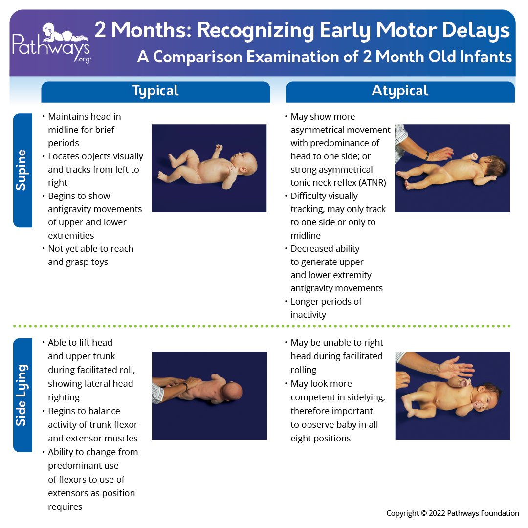 Have you been following our 2 Month Typical/Atypical Motor Development series? Download this printable handout for FREE in English, Spanish, Greek, Mandarin, Portuguese, and Ukrainian: bit.ly/44PDLTw #physio #pediatrictherapy #motorskills #medtwitter