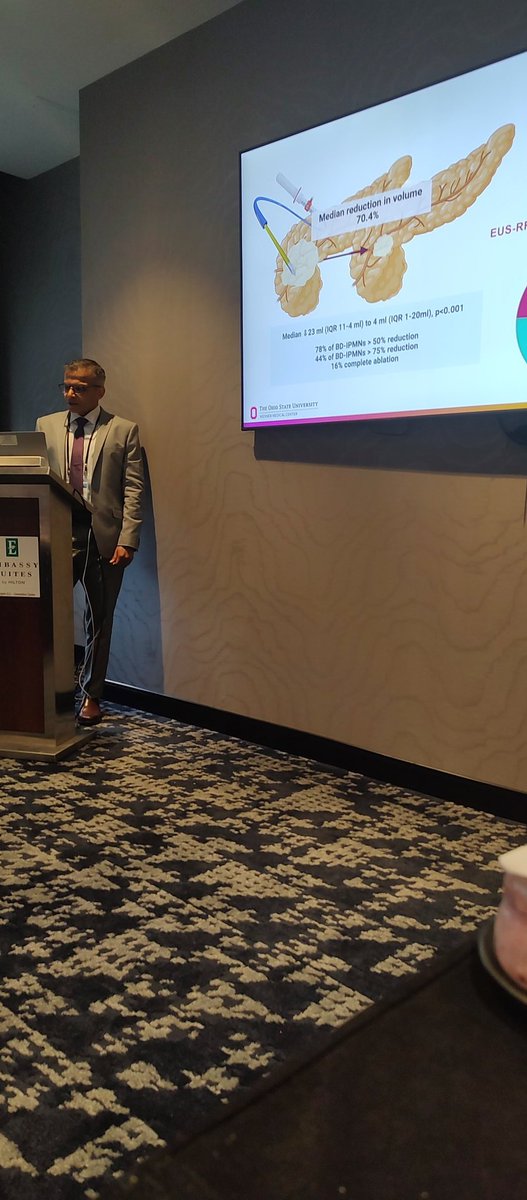 Cyst consortium highlights <a href="/som_krishna/">Somashekar Krishna, MD, MPH</a> working to #ERASE pre cancerous pancreatic cysts
<a href="/GIPapachristou/">Georgios Papachristou</a> <a href="/EricaParkMD/">Erica Park</a> <a href="/HamzaWShah/">Hamza Shah</a> <a href="/PeterLee1209/">Peter J Lee</a> <a href="/Jarshah4/">Raj Shah</a> @AnjuliLuthra_MD <a href="/OSUWexMed/">The Ohio State University Wexner Medical Center</a>