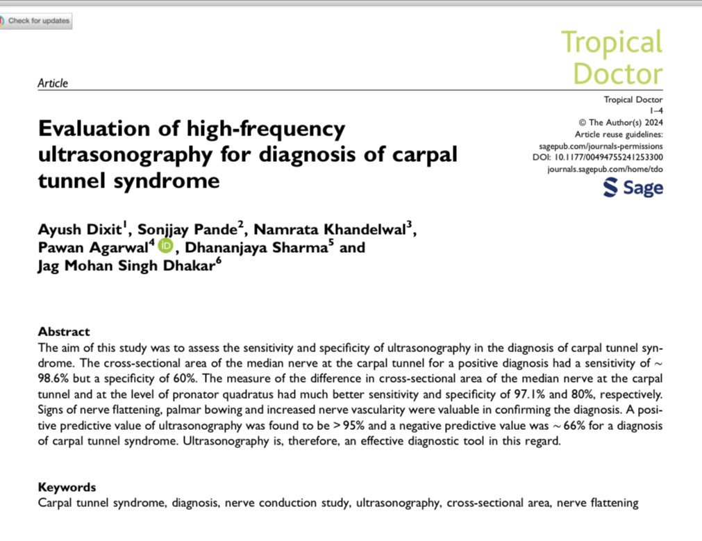 Happy to share our latest “USG is effective for diagnosis of Carpel Tunnel Syndrome” Great work as always by my favourite coauthor @drpa ❤️ Simpler the idea, better it is! 🔥😊🔥 #Occam’sRazor #SimpleSolutions #GlobalSurgery