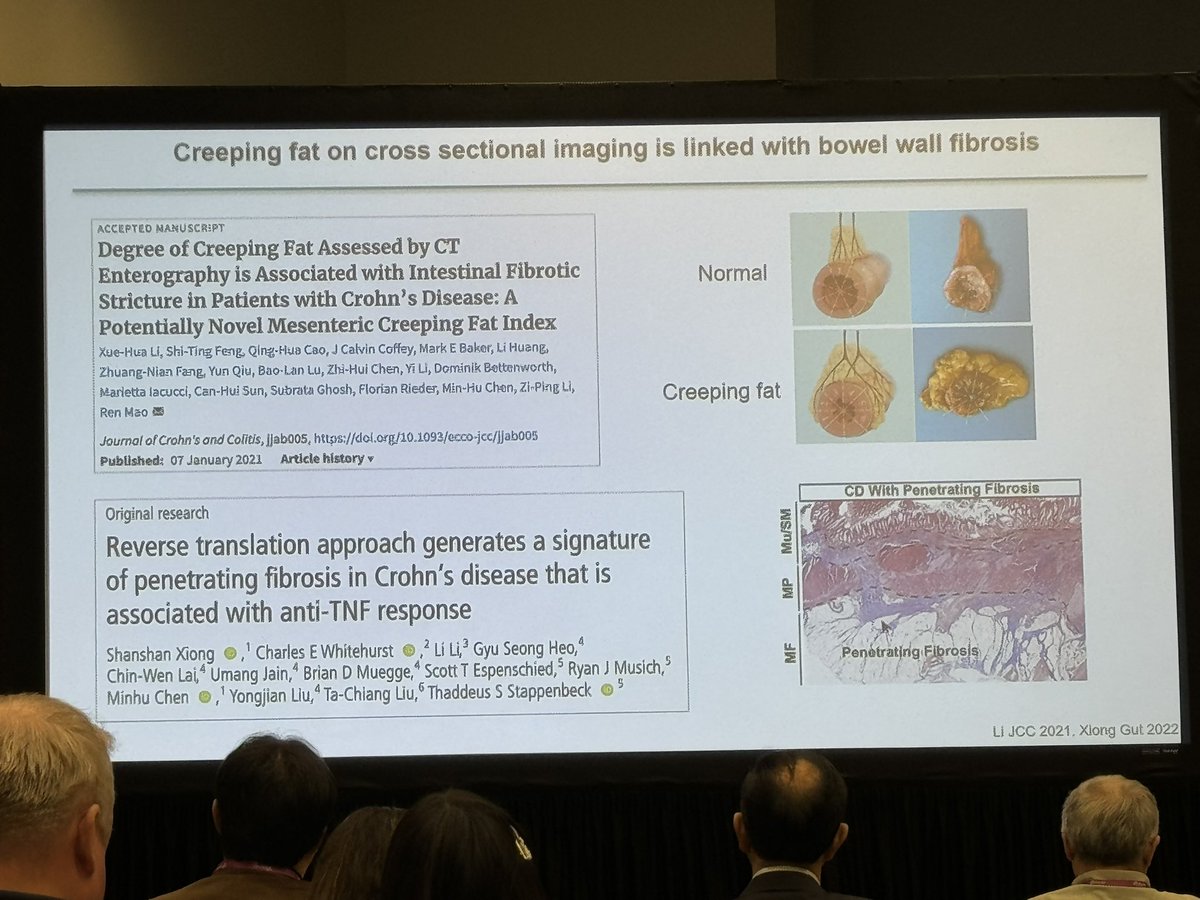 Amanda Johnson, MD (@amjohnsonmd) on Twitter photo Intriguing talk from <a href="/IBD_FloMD/">Florian Rieder</a> on creeping fat (CF) and CD stricturing
✅CF persists following endoscopic remission, and is immunologically active
✅CF assoc w/ smooth muscle proliferation/stricturing
✅degree CF on CTE correlates with intestinal fibrotic stricturing Intriguing talk from <a href="/IBD_FloMD/">Florian Rieder</a> on creeping fat (CF) and CD stricturing
✅CF persists following endoscopic remission, and is immunologically active
✅CF assoc w/ smooth muscle proliferation/stricturing
✅degree CF on CTE correlates with intestinal fibrotic stricturing