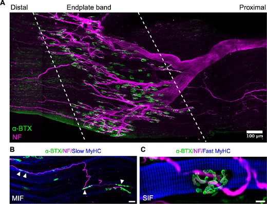 ARVOiovs's tweet photo. Mary Whitman et al. @BostonChildrens @harvardmed 
find that Neuromuscular Junction Development Differs Between Extraocular and Skeletal Muscles and Between Different Extraocular Muscles, https://t.co/8ZqYC12qWR. https://t.co/s2Je7HeLia