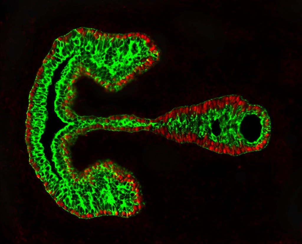 #SciArt for #NSLHM: Developing mouse vocal fold tissue in the embryonic mouse. Credit: #NIDCDgrantee Drs. Vlasta Lungova & Susan Thibeault, @UWMadison