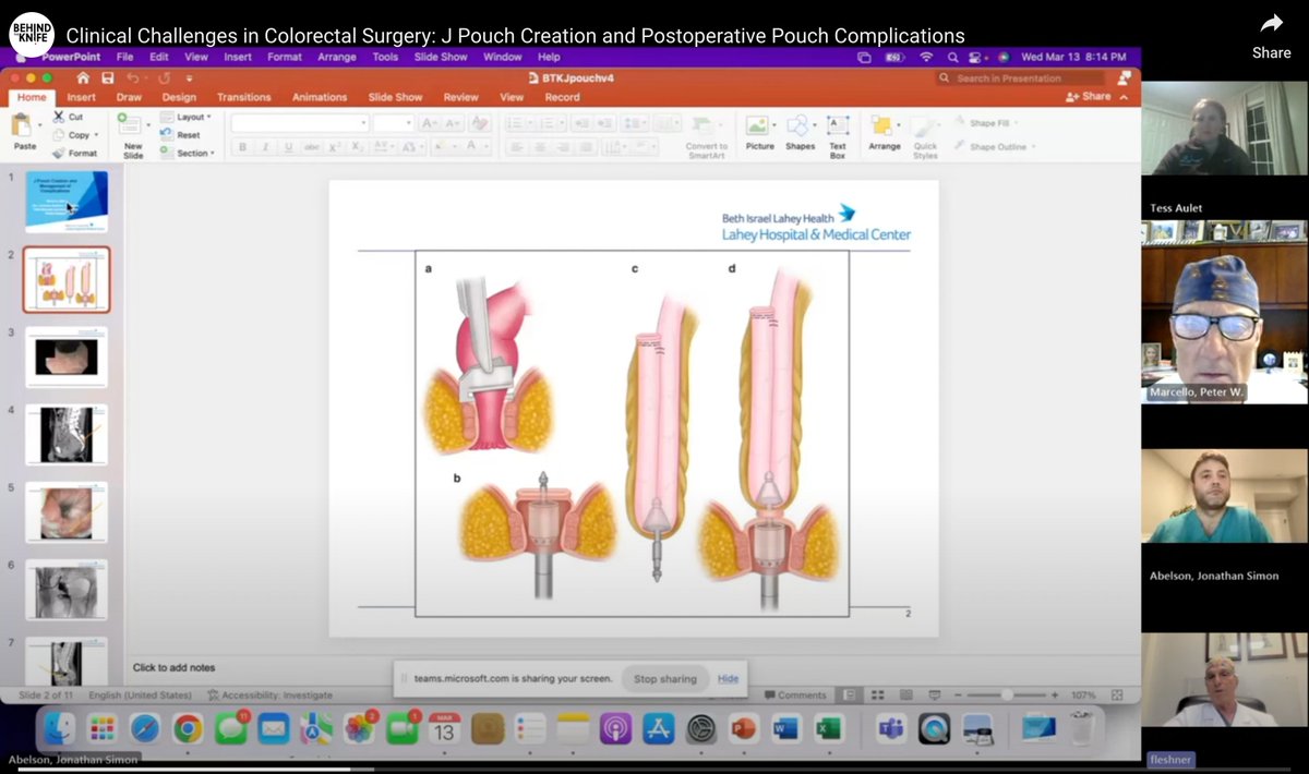 💩 CLINICAL CHALLENGE 💩 @LaheySurgery @jabelsonmd @TessAulet @peterwmarcello1 @PhilFleshnerMD DOMINATE THE DAY in their latest episode on J pouch creation and challenges. 🎧app.behindtheknife.org/podcast/clinic…🎧 Or watch 🎥 app.behindtheknife.org/video/clinical…