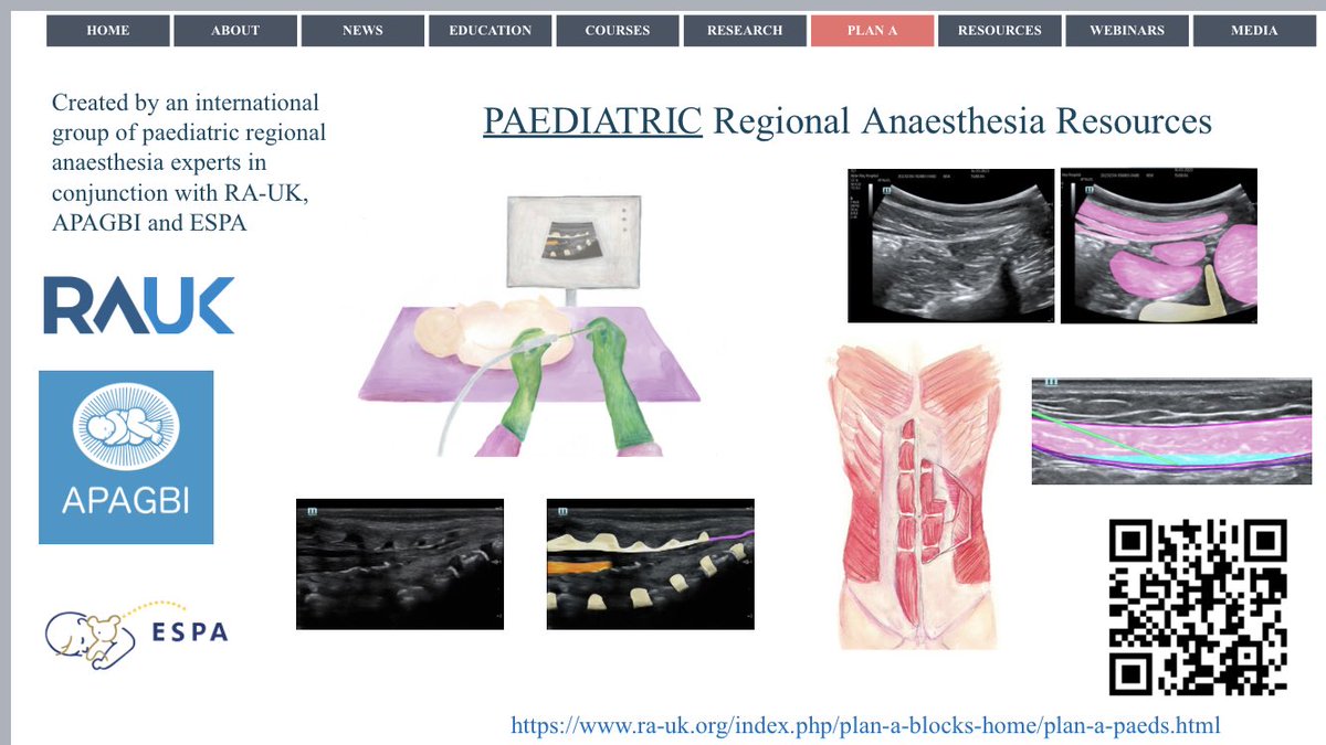@RegionalAnaesUK @APAGBI JUST LAUNCHED at #APAGBI24 An amazing collaboration between RAUK, APAGBI and ESPA of regional anaesthesia resources for paediatrics - tips, tricks, images, artist drawings, videos… lots more to come as well! Available on the RAUK website now!