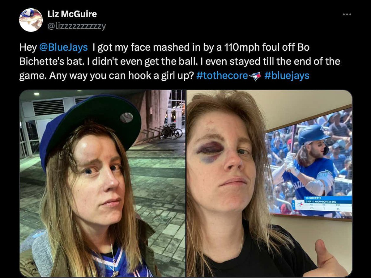 barstoolsports's tweet photo. Blue Jays Fan Goes Viral For Taking A 110 MPH Bo Bichette Foul Ball Off The Forehead And Taking It Like A Champ Even Though She Didn't Even Get To Keep The Ball https://t.co/jOKiG2zxDi https://t.co/jx7FHGiQ9k