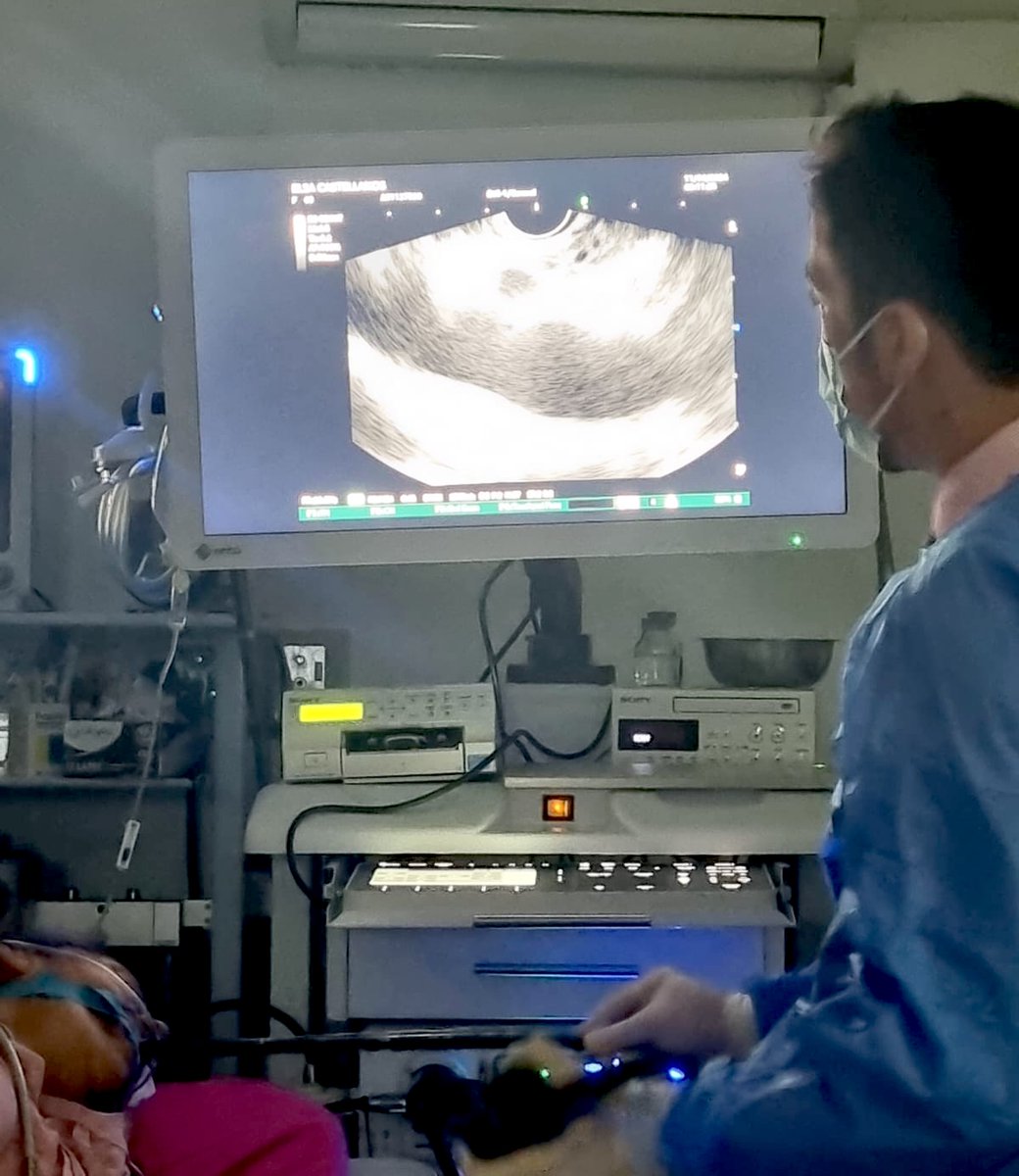 IGSS_gt's tweet photo. Tecnología de última generación para el área de Gastroenterología

El Hospital General de Enfermedades #IGSS cuenta ahora con un nuevo equipo de última generación, se trata del Ultrasonido Endoscopio Lineal, que permite diagnósticos más precisos, con el objetivo de brindarles a sus afiliados una mejor calidad en los servicios.

Este aparato tiene doble funcionalidad, ya que con él se puede realizar un ultrasonido y una endoscopia; otra de las ventajas de esta innovación es que cuenta con imágenes de alta resolución, permitiendo visibilizar los órganos que están cerca del tubo digestivo como el esófago, estómago, duodeno, páncreas, inclusivo el recto y ver más profundo como los ganglios y adenopatías.

Otro plus con el que cuenta es que al lograr atravesar el aparato digestivo, se puede tomar biopsias más profundas, proporcionando un diagnóstico certero y brindarle un tratamiento adecuado al paciente.

Cabe resaltar que este equipo realiza procedimientos de bajo riesgo, y en su mayoría pueden ser procedimientos ambulatorios, contrario hacer una biopsia por cirugía, que resulta  mucho más complejo.

Con estas innovaciones el #SeguroSocial continúa brindando respuestas integrales, con exámenes complementarios seguros, garantizando así el bienestar de sus afiliados, beneficiarios y derechohabientes. #SomosIGSS