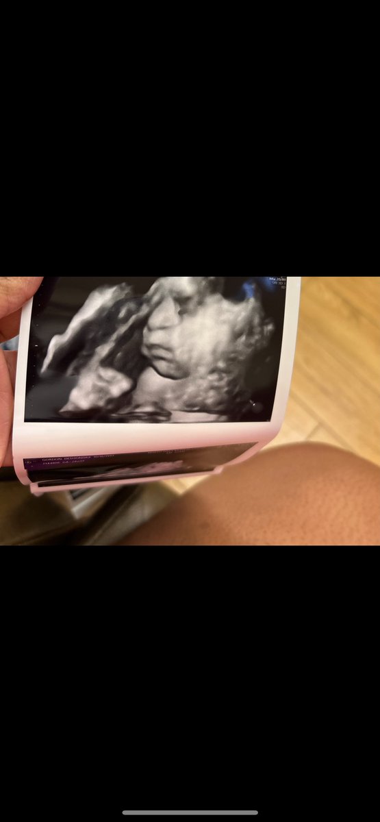 caramelcutiee_'s tweet image. #fatface #chubbycheeks 🥰💕