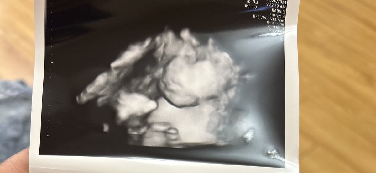 caramelcutiee_'s tweet image. #fatface #chubbycheeks 🥰💕