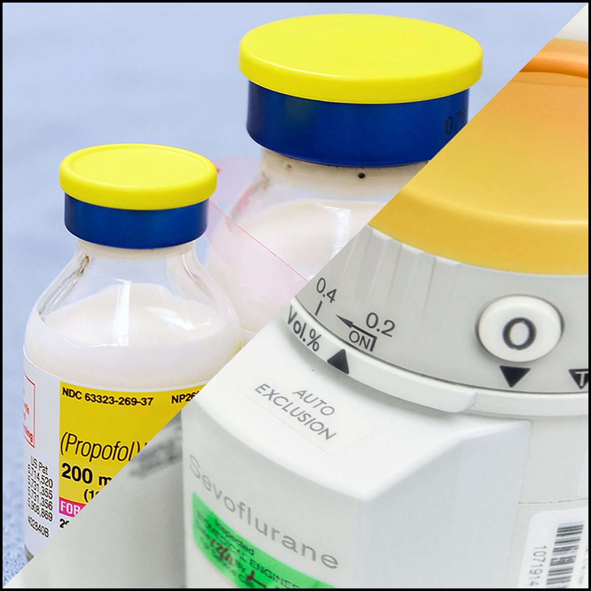Among patients undergoing bladder cancer surgery under general #anesthesia, there was no statistically significant difference in long-term overall survival associated with the choice of propofol or an inhaled volatile maintenance. Read more: ow.ly/4xq550RNHiW