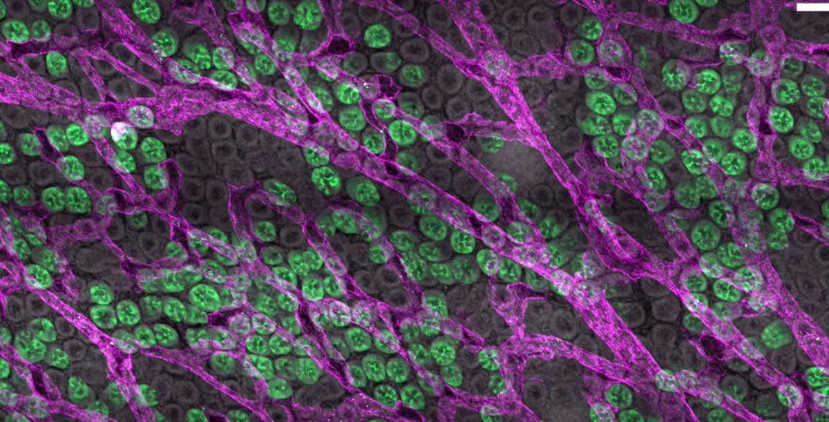 Brisa Palikuqi (@brisapalikuqi) on Twitter photo I am excited to announce that I have accepted a tenure track Assistant Professor position at the Yale Stem Cell Center and the Comparative Medicine department at the Yale Medical School. I am excited to announce that I have accepted a tenure track Assistant Professor position at the Yale Stem Cell Center and the Comparative Medicine department at the Yale Medical School.