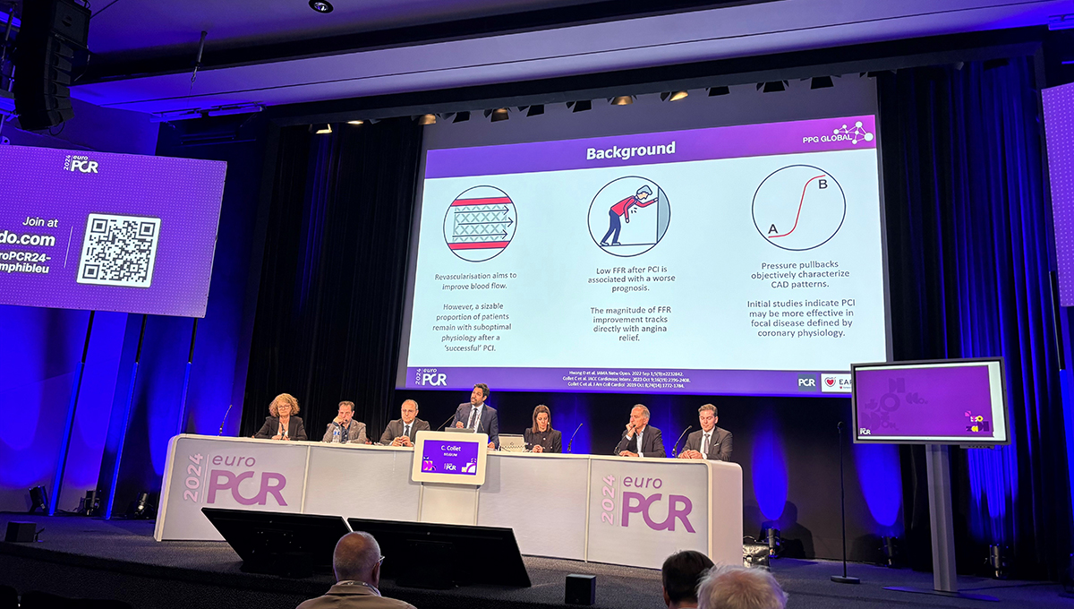 FFR-Derived Metric Can Identify Focal CAD Best Suited to PCI dlvr.it/T78nvj