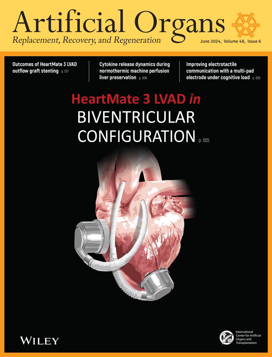 Check out the June issue information👇 tinyurl.com/yjfy7rtu 
#OnTheCover: #HeartMate3 #LVAD in #Biventricular configuration

#BiVAD #MechanicalCirculatorySupport