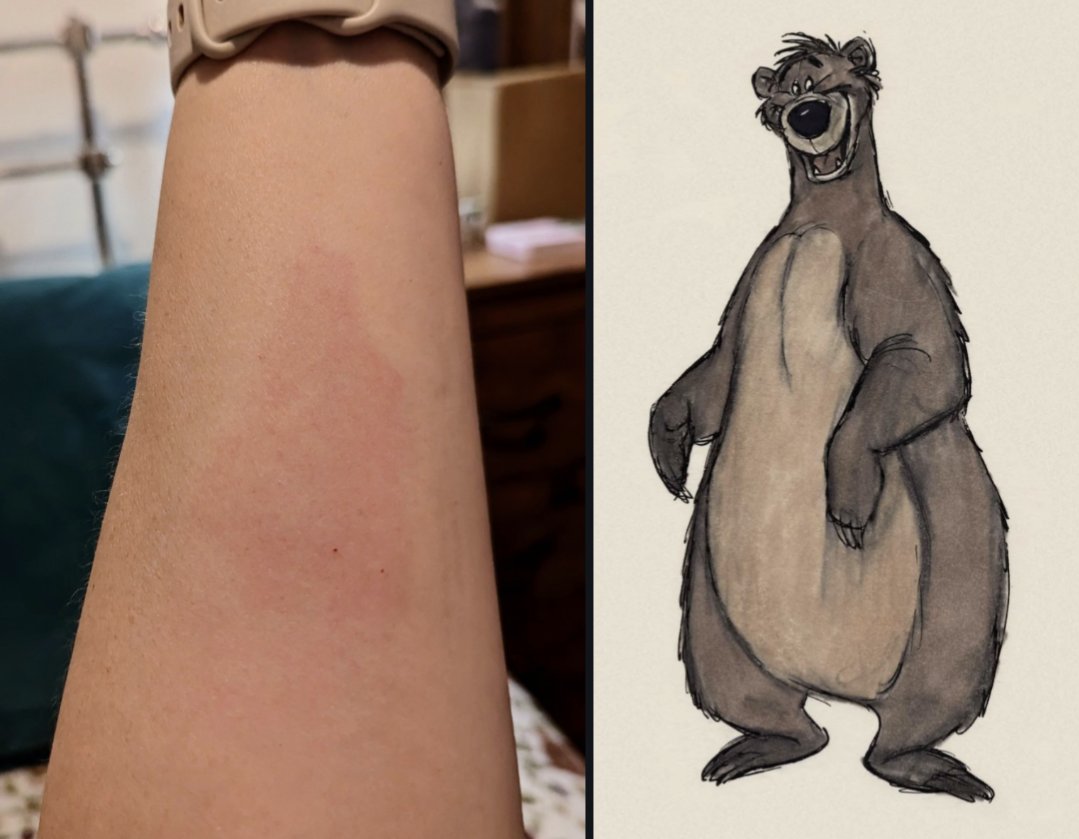 Cmdr_Amanda's tweet photo. Today I was stung by a bee and the mark it left looks like Baloo! 
He did sing 'the bees are buzzing in the tree to make some honey just for me' so I think it all fits!
Very cute 😊🐝
#bees #baloo #junglebook https://t.co/PKiuCs10Ou