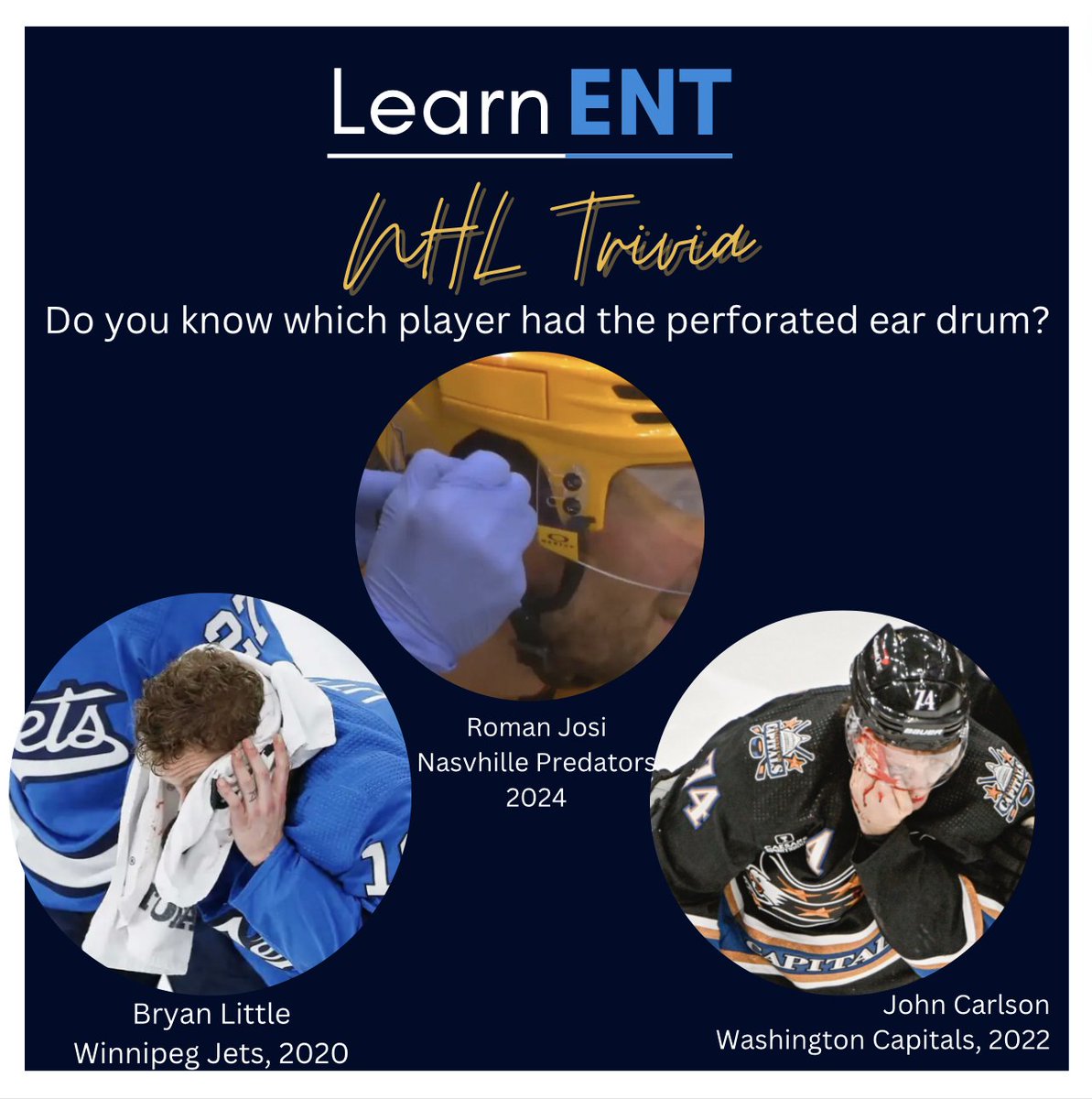 LearnENT's tweet photo. It’s hockey night in Canada! Tonight, two Canadian teams (#canucks vs #oilers) will be facing off in Game 7 to head off to the western conference finals. 

Ear injuries from slap shots are common in the NHL, and can result in pinna lacerations and TM perforations! https://t.co/APkSae04zR
