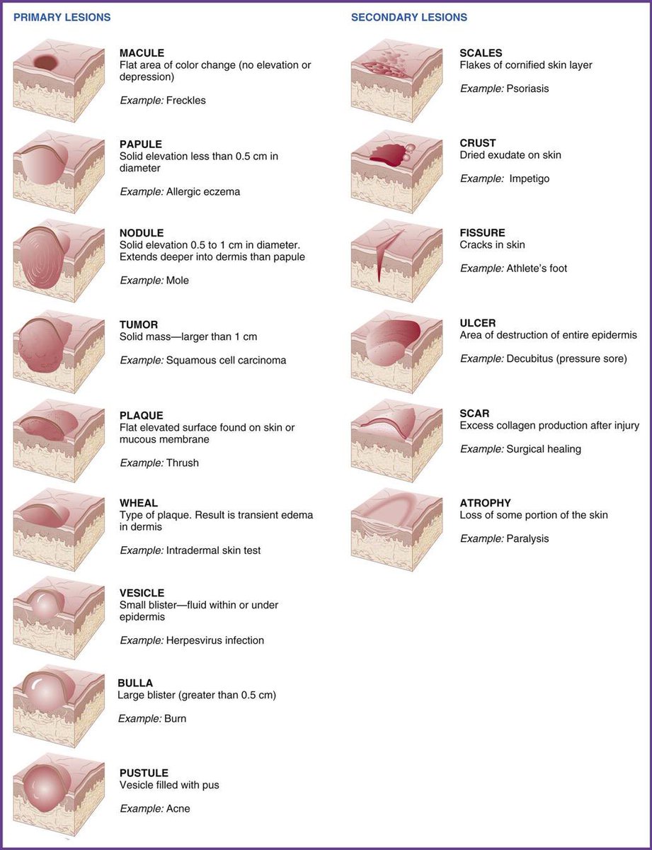 Medical_MD1's tweet photo. Quick Review on 

Skin lesions ✨🤩

. https://t.co/z3paPDjKGL