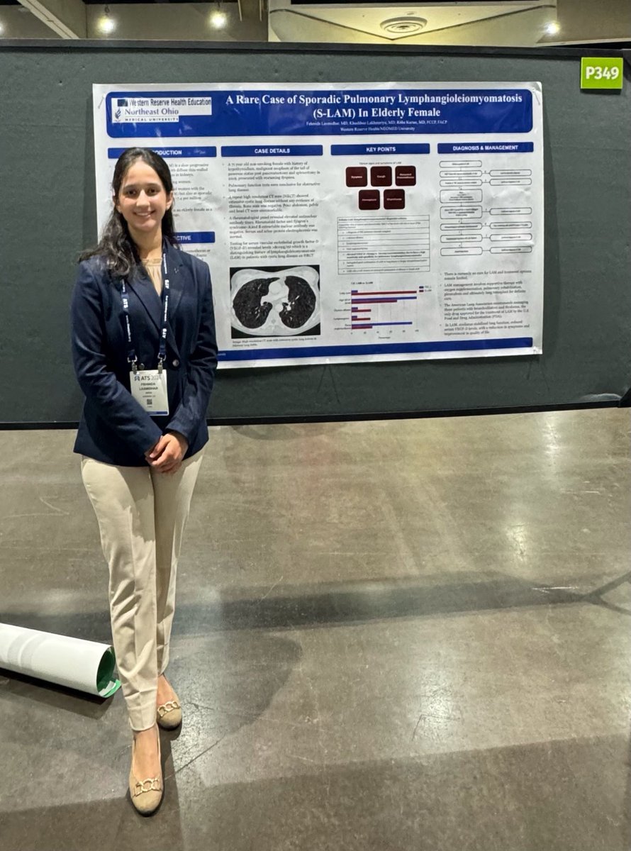 Fehmida Laxmidhar (@laxmidhar2208) on Twitter photo At the American Thoracic Society ATS’24👩🏻⚕️🩻
Shedding light on Lymphangioleiomyomatosis, a slow progressive metastatic smooth muscle cell-like neoplasm of lung, in the elderly population.
#ATS24 #LungCancer #Lymphangioleiomyomatosis
<a href="/atscommunity/">American Thoracic Society (ATS)</a> <a href="/IM_WRHE/">Internal Medicine WRHE/NEOMED program</a> <a href="/NEOMEDedu/">Northeast Ohio Medical University (NEOMED)</a> At the American Thoracic Society ATS’24👩🏻⚕️🩻
Shedding light on Lymphangioleiomyomatosis, a slow progressive metastatic smooth muscle cell-like neoplasm of lung, in the elderly population.
#ATS24 #LungCancer #Lymphangioleiomyomatosis
<a href="/atscommunity/">American Thoracic Society (ATS)</a> <a href="/IM_WRHE/">Internal Medicine WRHE/NEOMED program</a> <a href="/NEOMEDedu/">Northeast Ohio Medical University (NEOMED)</a>