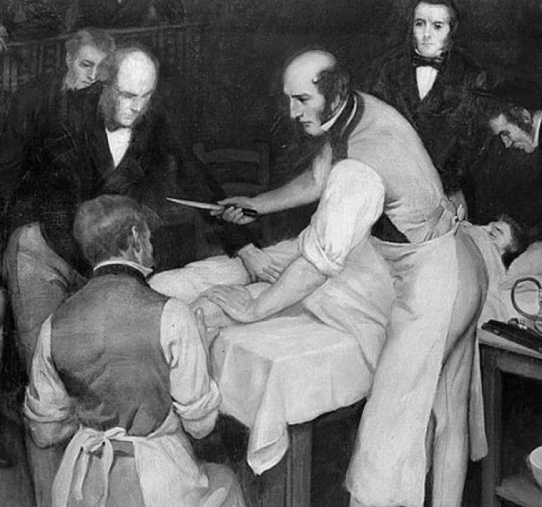 In the 1800s, Scottish surgeon Robert Liston became infamous for a surgery that led to an astonishing 300% mortality rate. 

He amputated a patient's leg in under 2.5 minutes, operating so swiftly that he inadvertently amputated his assistant's fingers and slashed a spectator's