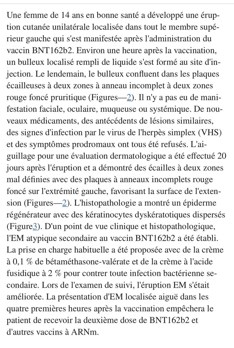 À lire ! Une présentation inhabituelle d’érythème polymorphe à la suite du vax COV ARNm chez un patient pédiatrique: jeune fille 14 ans cf figure 1 doi.org/10.7759%2Fcure…