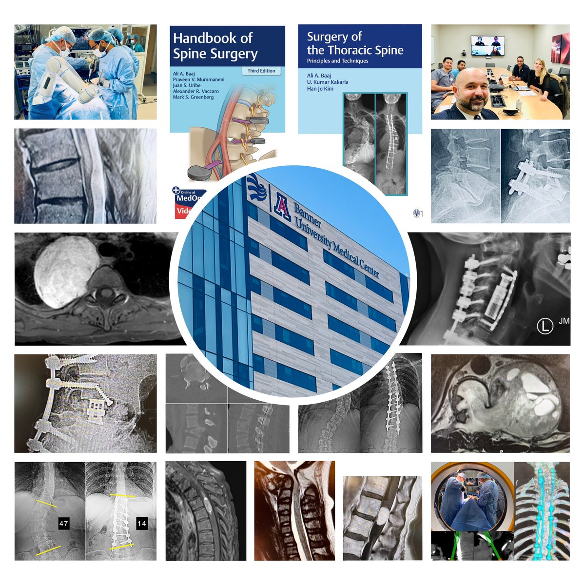 AliBaajMD's tweet photo. One of two clinical spine fellowship positions with our team at #BannerSpine in Phoenix remains open for 2025-2026. @AOSpine accredited, complex degen/deformity/onc with both traditional/MIS exposure. Nav/robotics. Neuro/Ortho faculty. Jr attending appointment. (ACGME nsg grads) https://t.co/ATl4GYzj5g