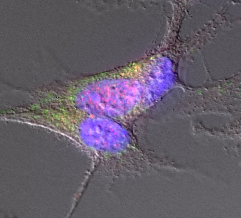 IdAB_CSIC's tweet photo. Investigadoras del @IdAB_CSIC lideradas por nuestra Científica Jaione Valle descubren la presencia de amiloides bacterianos en la microbiota intestinal asociada con la enfermedad de Parkinson. El estudio ha sido publicado en la prestigiosa revista científica Nature Communcations. https://t.co/NytLMl9EL5