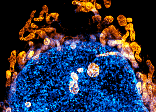 spirochrome's tweet photo. The new mitochondrial probe PKmito ORANGE FX in now available!

✅ Optimized for PFA or GA fixed cell mitochondria imaging
✅ Highly suited for STED imaging
✅ Compatible with immunostaining and CLEM

https://t.co/GPBcG2nt8m

Order it now from our distributors and take advantage of the 30% introductory discount.

Read more about PKmito ORANGE FX in the PNAS article by @ZhixingChen2 https://t.co/eIG6uFi0nW