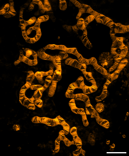 spirochrome's tweet photo. The new mitochondrial probe PKmito ORANGE FX in now available!

✅ Optimized for PFA or GA fixed cell mitochondria imaging
✅ Highly suited for STED imaging
✅ Compatible with immunostaining and CLEM

https://t.co/GPBcG2nt8m

Order it now from our distributors and take advantage of the 30% introductory discount.

Read more about PKmito ORANGE FX in the PNAS article by @ZhixingChen2 https://t.co/eIG6uFi0nW