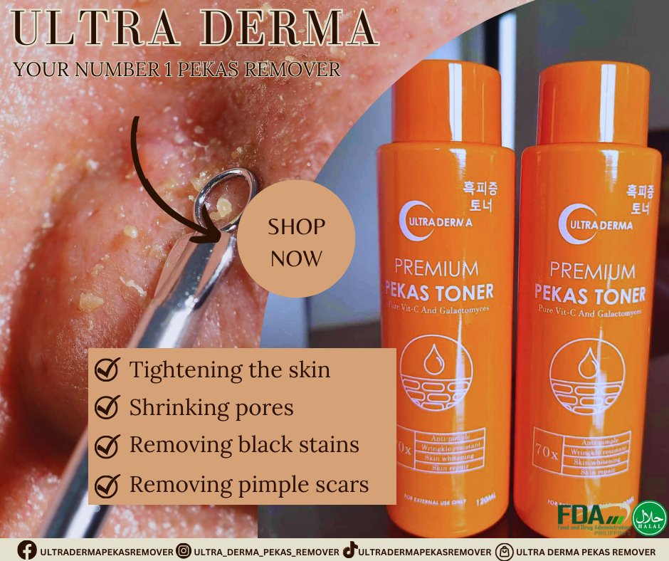 🧡🧡Ultra Derma🧡🧡
🧡🧡Pekas Toner 🧡🧡
#ultradermapekastoner
#ultradermatrio
#ultradermaduo
#ultradermatomatokojicsoap
#ultradermapekascreamremover
#ultradermapekascream
#FDAapprovedProduct
#dermatologisttested
#Skincare
#Beauty
#SkinCareRoutine
#HealthySkin
#GlowingSkin