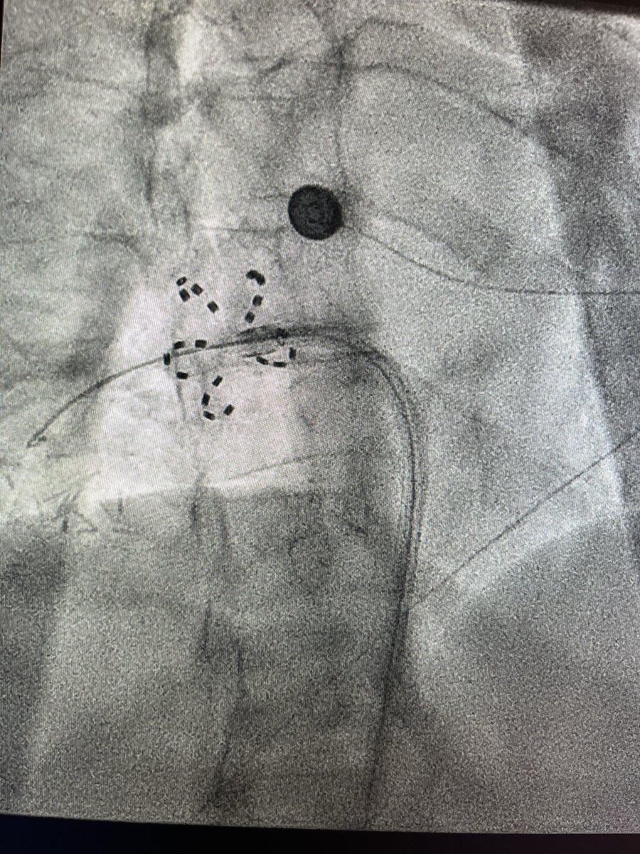 maarrocamora's tweet photo. @gabims85 @hjoan23 @BSCCardiology @cabrerasandra82 @Amin_elamrani_ @Lara_Prieto_ @franquet_nuria Perfect flower 🌸 https://t.co/SaScWunZHe