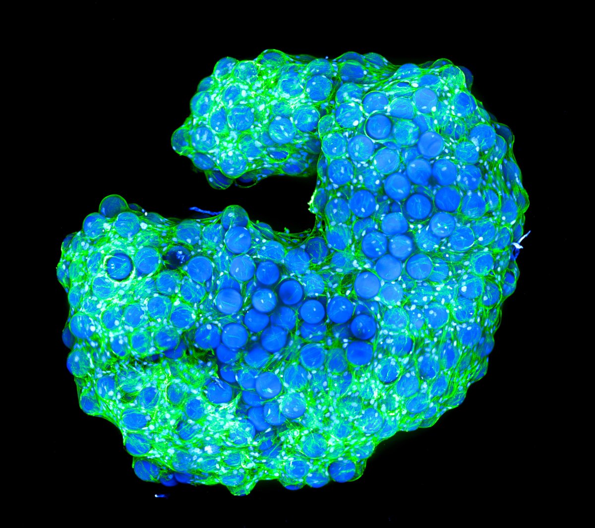ibidiCells's tweet photo. 🤩 Microgel Harmony 🍇
🔬👩🔬 Scientific artwork by Selin Bulut and Daniel Günther, DWI - Leibniz Institute for Interactive Materials, @RWTH, Aachen, Germany.
@selinbllt
#microgel #fibroblast #confocal #microscopy #cellbiology #innovation #science #sciart #cellsinfocus #bioart https://t.co/I9E32hkW3F