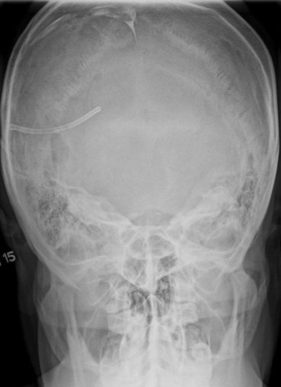 Mohammed Asiri☢️ tweet media