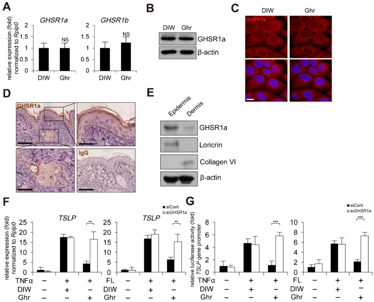 🌟#notablepaper 📚Ghrelin Represses Thymic Stromal #Lymphopoietin Gene Expression through Activation of #GlucocorticoidReceptor and #ProteinKinase C Delta in Inflamed #Skin #Keratinocytes 🔗mdpi.com/1572426 👨‍🔬By Prof. Bong-Gun Ju et al @MDPIOpenAccess @MDPIBiologySubj