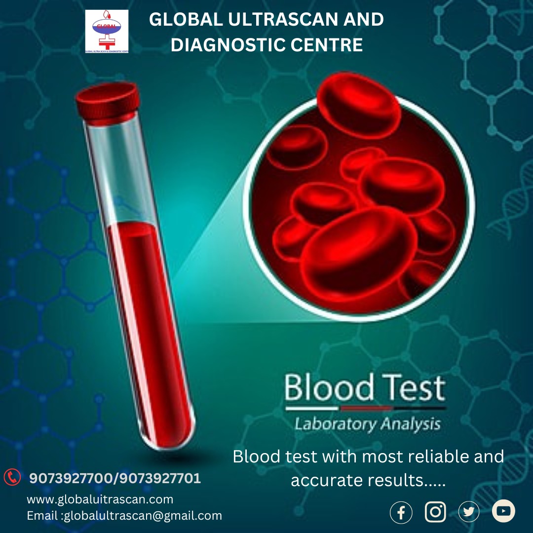 BEST DIAGNOSTIC CENTRE
#Global Ultrascan & Diagnostic Centre
Home Collection Available
#globalultrascan#globalultrascananddiagnosticcentre#bloodtesting#pathologylab#bloodhomecollection#homebloodcollection#pathologytests#homecollection#globalultrascananddiagnosticcentre