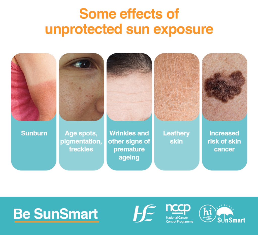 FACT: Most skin cancers are caused by sunbeds use&over exposure to the sun, long term or short periods of intense to burning. The UV light of the sun damages the skin cell DNA that can happen years before a cancer develops.
#SunSmart
#SkinCancerAwarenessMonth 
@stjamesdublin
