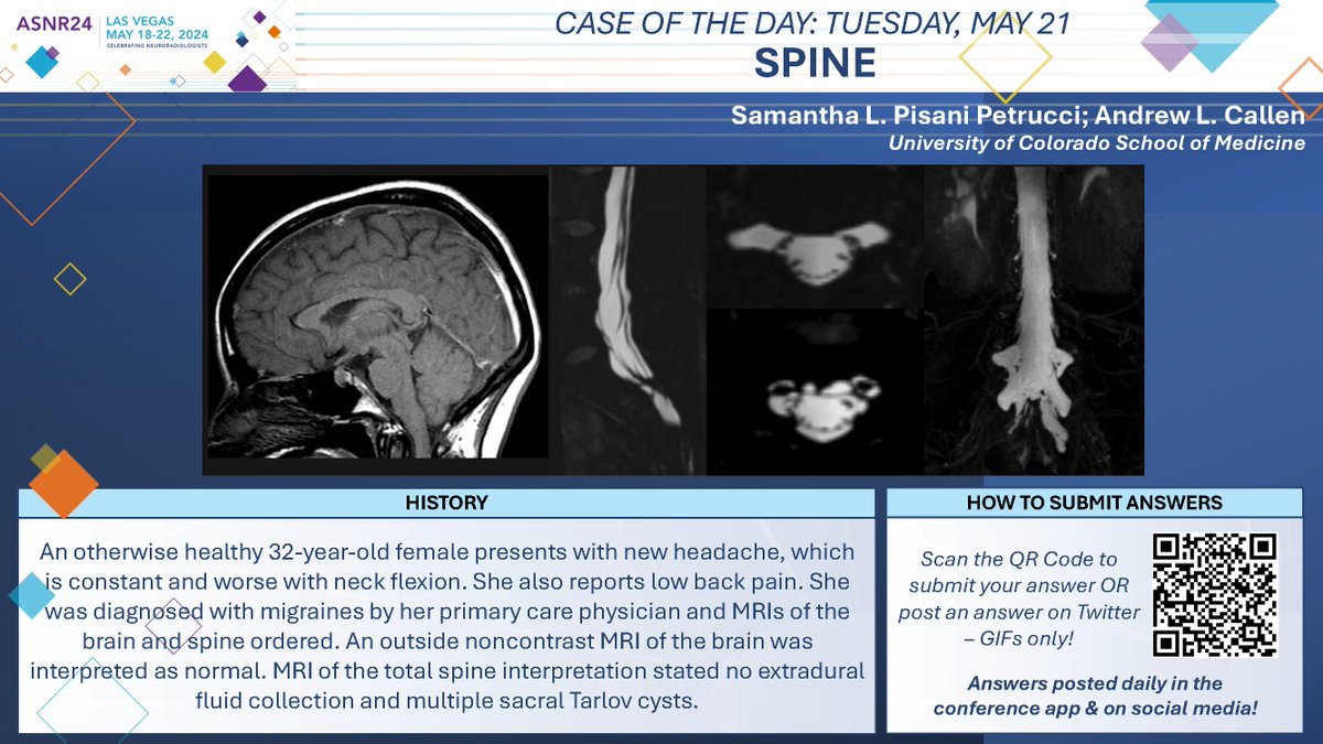 #ASNR24 #COTD: Tuesday Spine Thx to Drs. Samantha Pisani Petrucci and Andrew Callen @NeuroRadSam @AndrewCallenMD NO SPOILERS!!! Give answers as GIFs ONLY. Submit answers for a chance to win prizes! Answer tomorrow morning. #ASNR24 #Neuroradiology #FOAMed #RadRes #MedEd