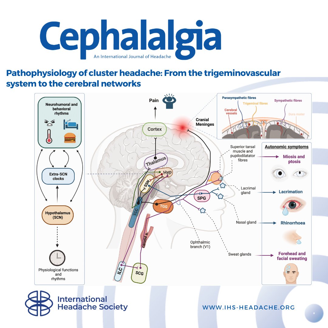 This review will examine clinical neurophysiology studies, including electrophysiological and functional neuroimaging, to determine if they might help us construct a neurophysiological model of cluster headache. doi.pulse.ly/aarnhpj73c #headache #clusterheadache #neurology