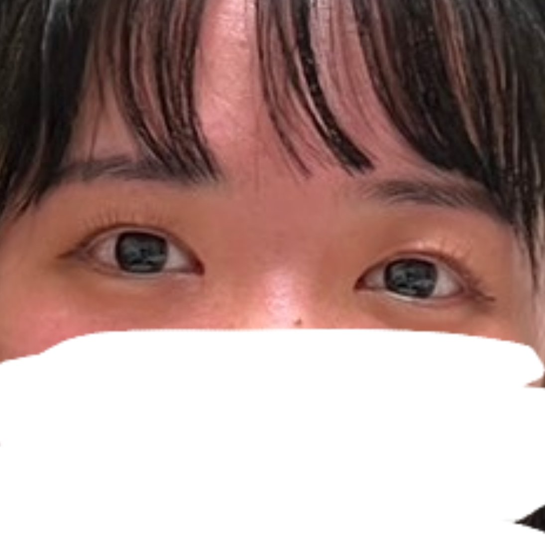 m_oilqq's tweet photo. 整形してから自分の目の形好きすぎる。
一重だけど確実にデカイ。
4枚目整形前。死。笑 https://t.co/ykTuqrRl5R
