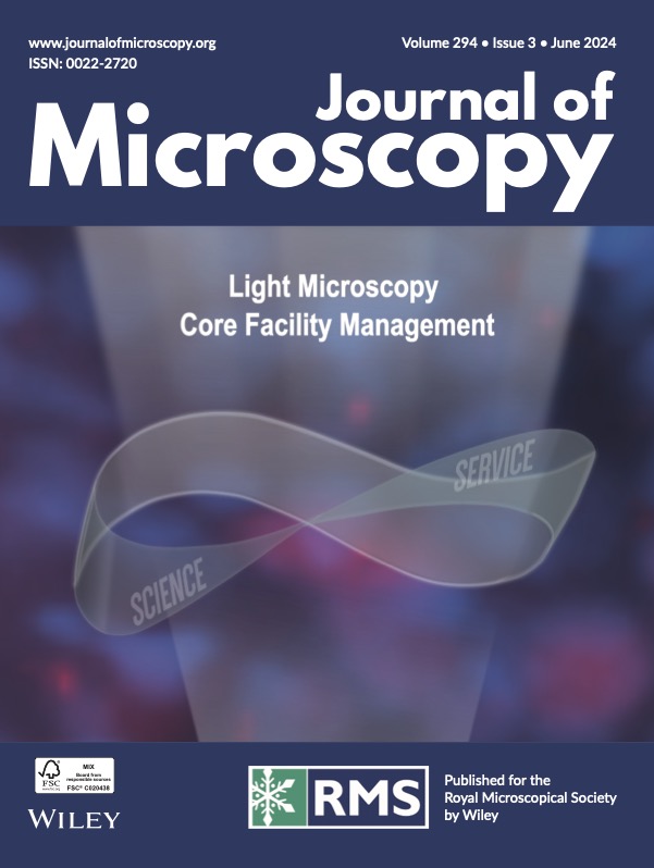 JournalofMicroscopy (@jofmicroscopy) on Twitter photo 📣We are pleased to announce the publication of the Light Microscopy Core Facility Management special issue!
The issue was guest edited by <a href="/sebastianmunck/">sebastian munck</a> and Dr Kurt Anderson.
It features 15 papers, 13 are #OpenAccess, and is available to view here > onlinelibrary.wiley.com/toc/13652818/2… 📣We are pleased to announce the publication of the Light Microscopy Core Facility Management special issue!
The issue was guest edited by <a href="/sebastianmunck/">sebastian munck</a> and Dr Kurt Anderson.
It features 15 papers, 13 are #OpenAccess, and is available to view here > onlinelibrary.wiley.com/toc/13652818/2…