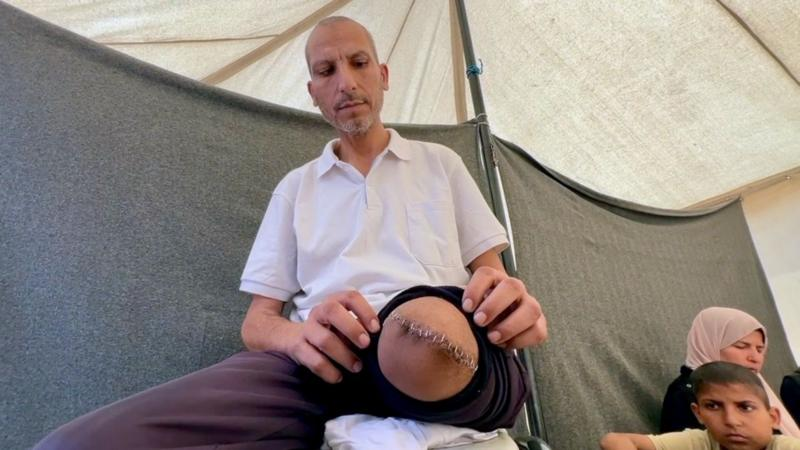 🚨BREAKING: BBC INVESTIGATION REVEALS DISTURBING CRIMES INSIDE ISRAELI HOSPITALS.

Medical workers in Israel have reported to the BBC that Palestinian detainees from Gaza are often shackled to hospital beds, blindfolded, sometimes kept naked, and forced to wear nappies, which one