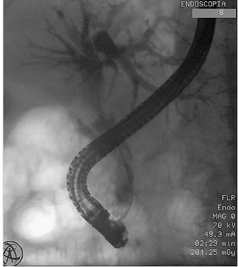 GE . Portuguese Journal of Gastroenterology (@GE_PortJGastro) / Posts / X