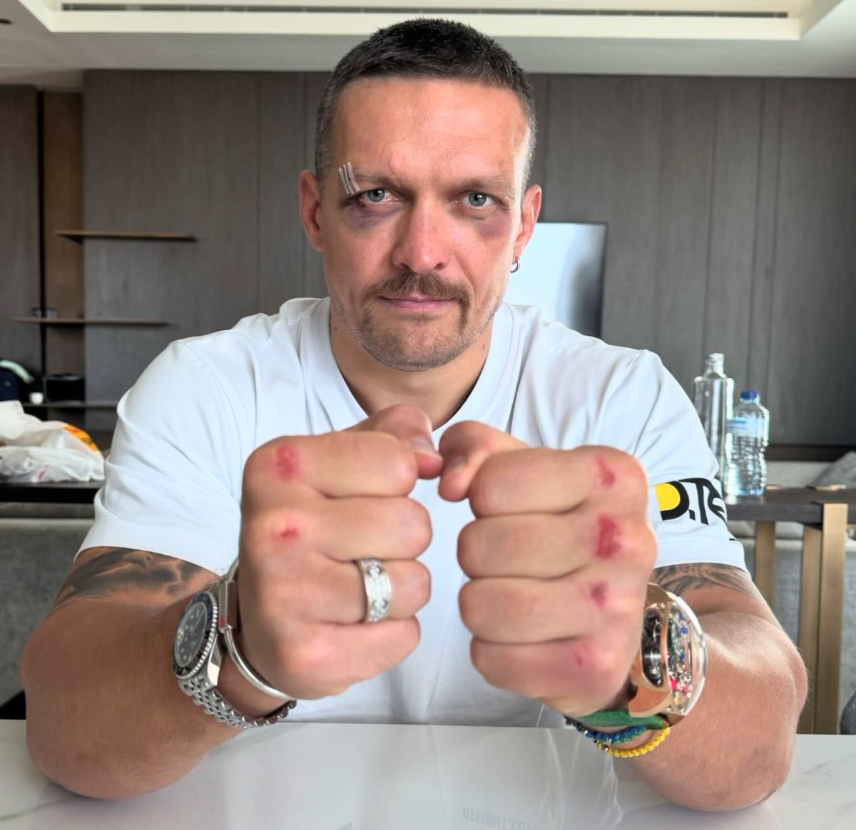 𝗨𝗡𝗗𝗜𝗦𝗣𝗨𝗧𝗘𝗗 battle scars 👑🫡

📸 @usykaa | #FuryUsyk #RiyadhSeason | @Turki_alalshikh